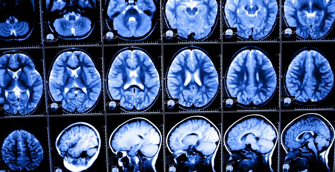 Cats and Mental&nbsp;Illness